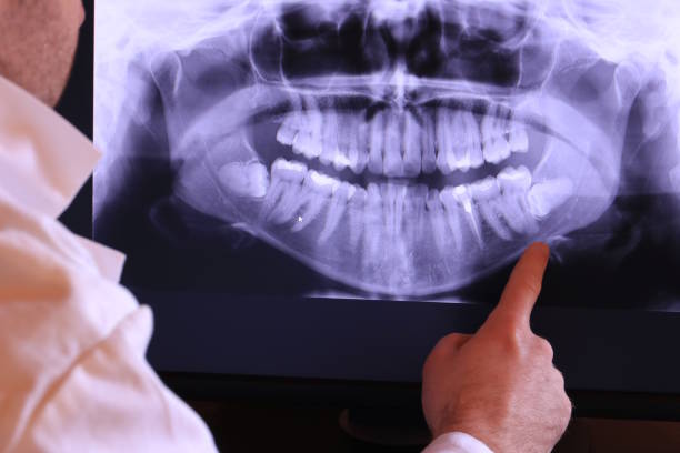 Best Emergency TMJ Treatment in Cabool, MO